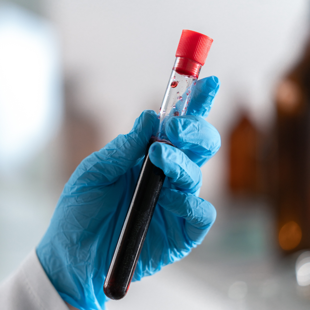 qué enfermedades puede detectar un examen de sangre